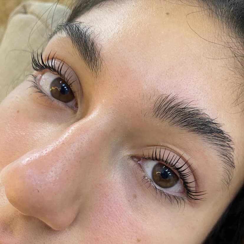 Resultado de micropigmentación 3