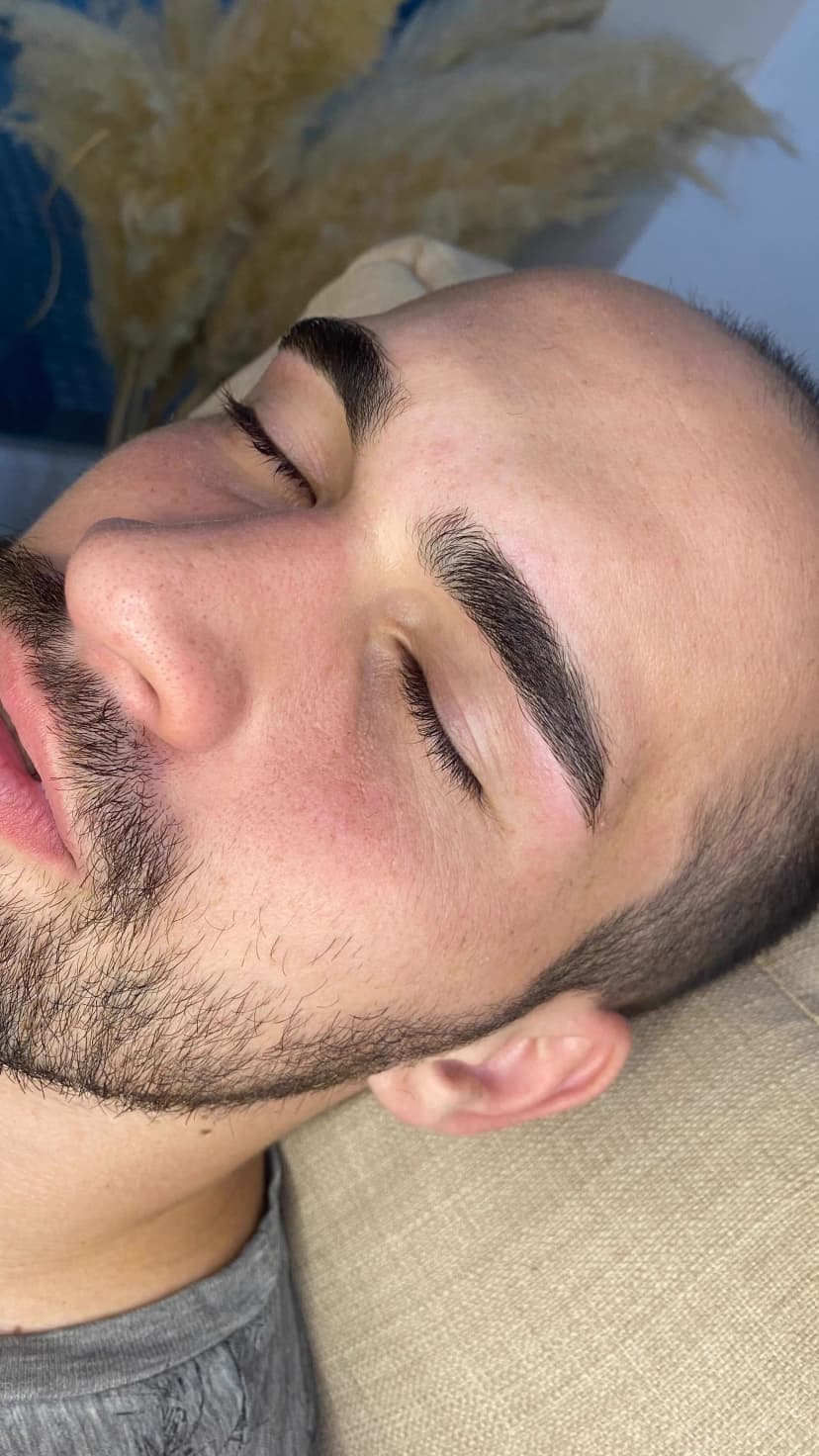 Resultado de micropigmentación 5